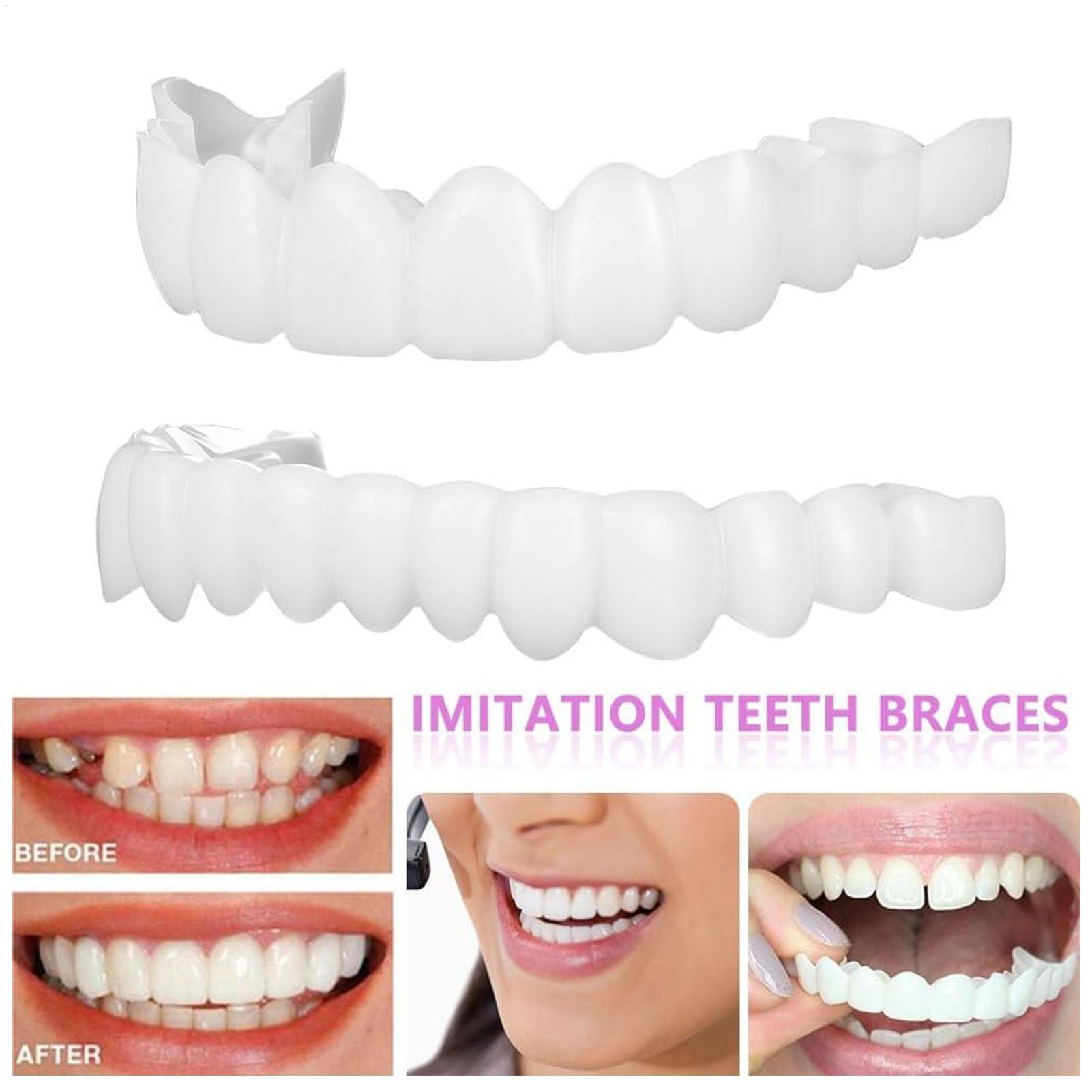 Teeth Whitening Veneers - Capa Dentária Superior e Inferior para