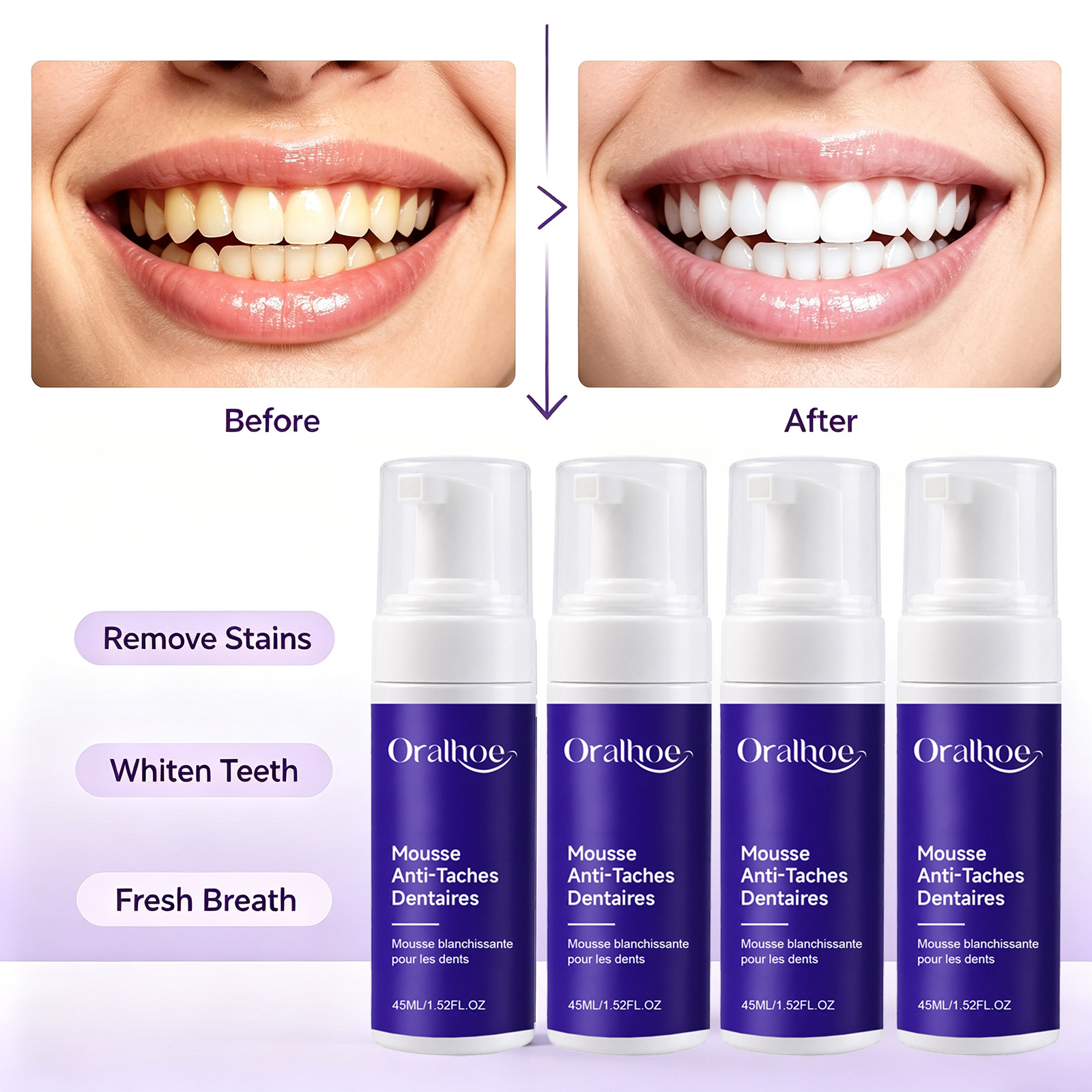 Teeth Whitening Routine - Espuma Dental Roxa Clareadora Segura para