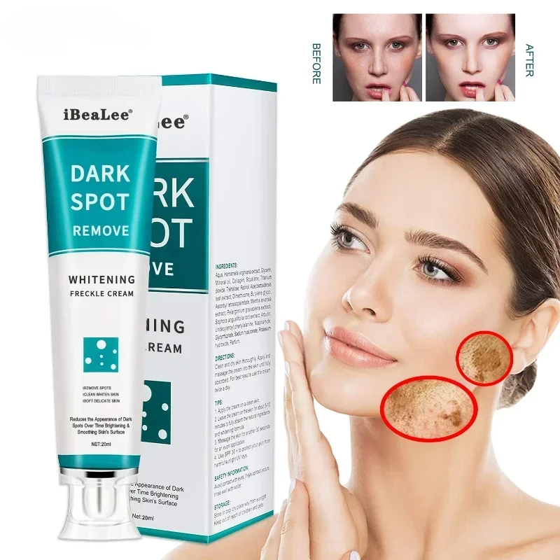 Charcoal Whitening Paste - Clareamento creme de sardas remover manchas