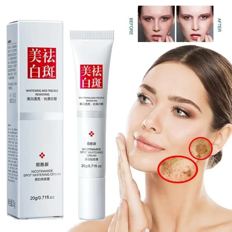 Charcoal Whitening Paste - Desaparece sardas manchas escuras creme facial