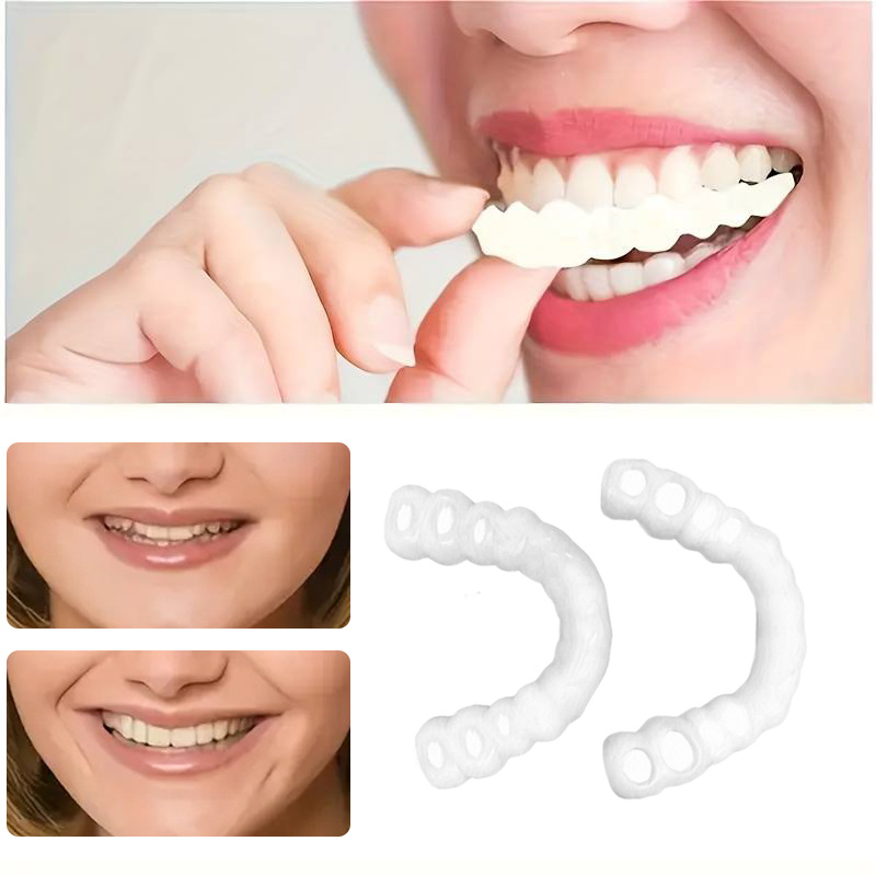 Teeth Whitening Veneers - On Smile Dental Cobertura para Dentes