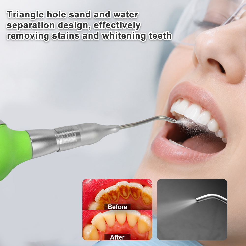 Polidor Dental a Ar com Dispos - Teeth Whitening Options avaliação e preço