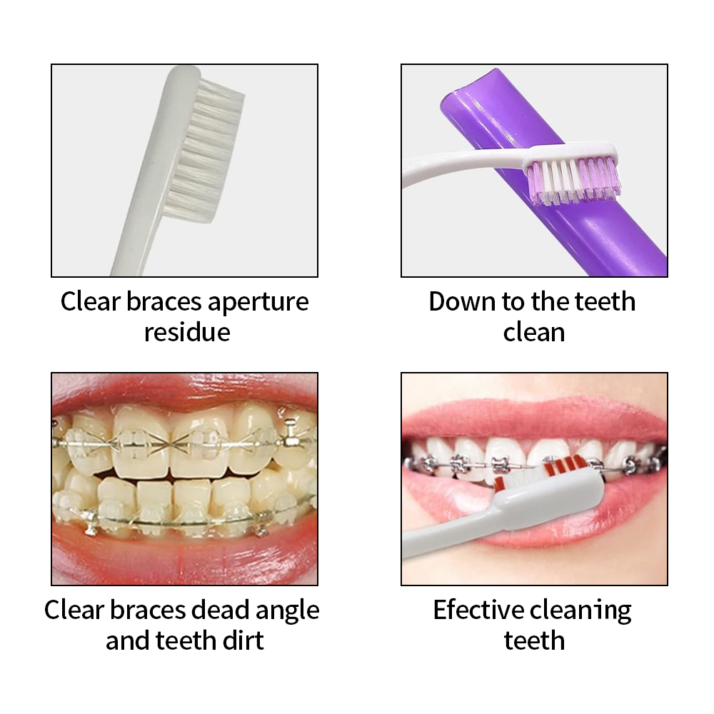 8 pçs/set ortodôntico kit esco - Teeth Whitening Brush avaliação e preço