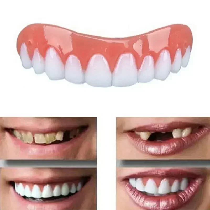 Novas Próteses Dentárias de Si - Teeth Whitening Veneers avaliação e preço