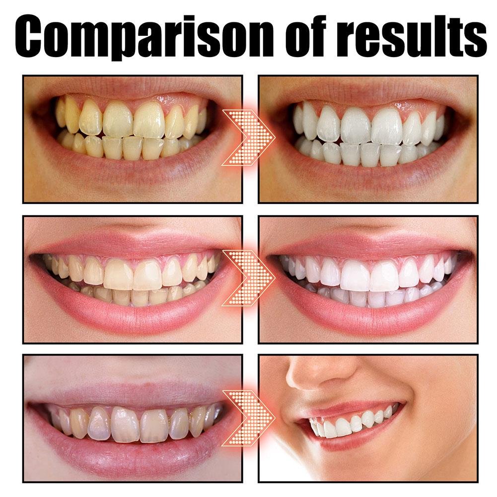 Enxaguante Bucal de Óleo de Co - Teeth Whitening Oil Pulling avaliação e preço