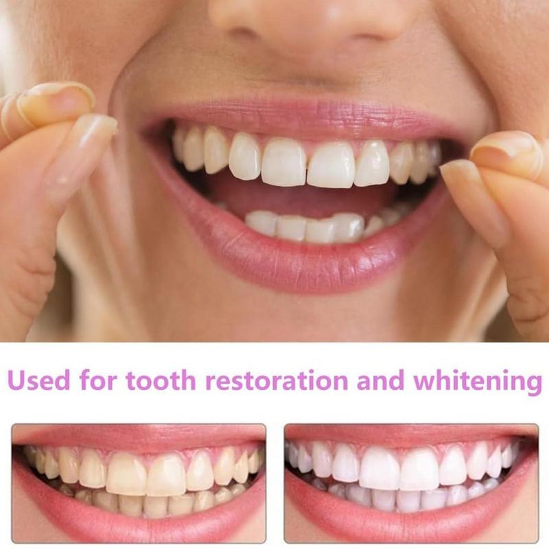 Encaixe em folheados de dentes - Teeth Whitening Veneers avaliação e preço