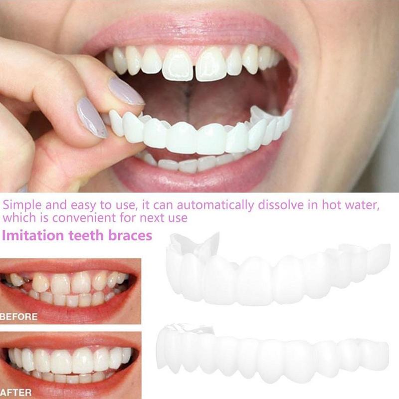 Encaixe em folheados de dentes - Teeth Whitening Veneers avaliação e preço