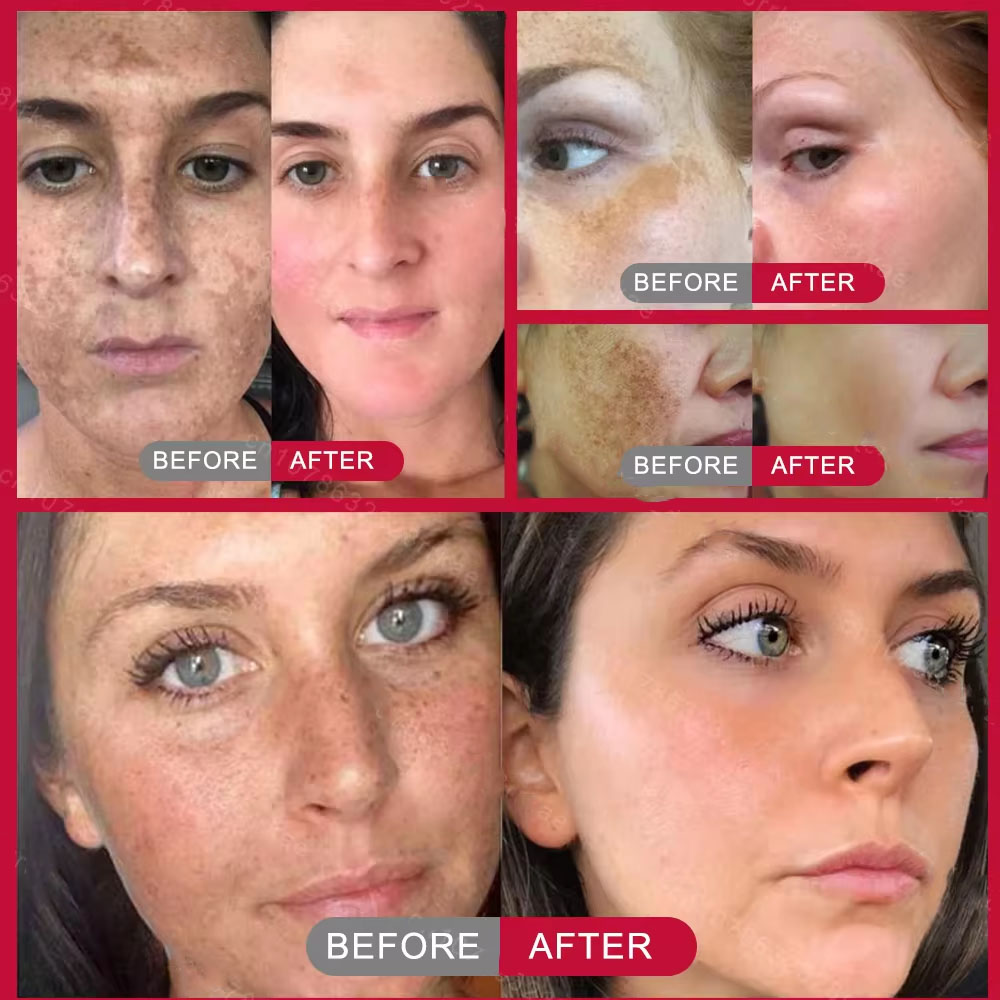 Creme Clareador Poderoso para  - Charcoal Whitening Paste avaliação e preço