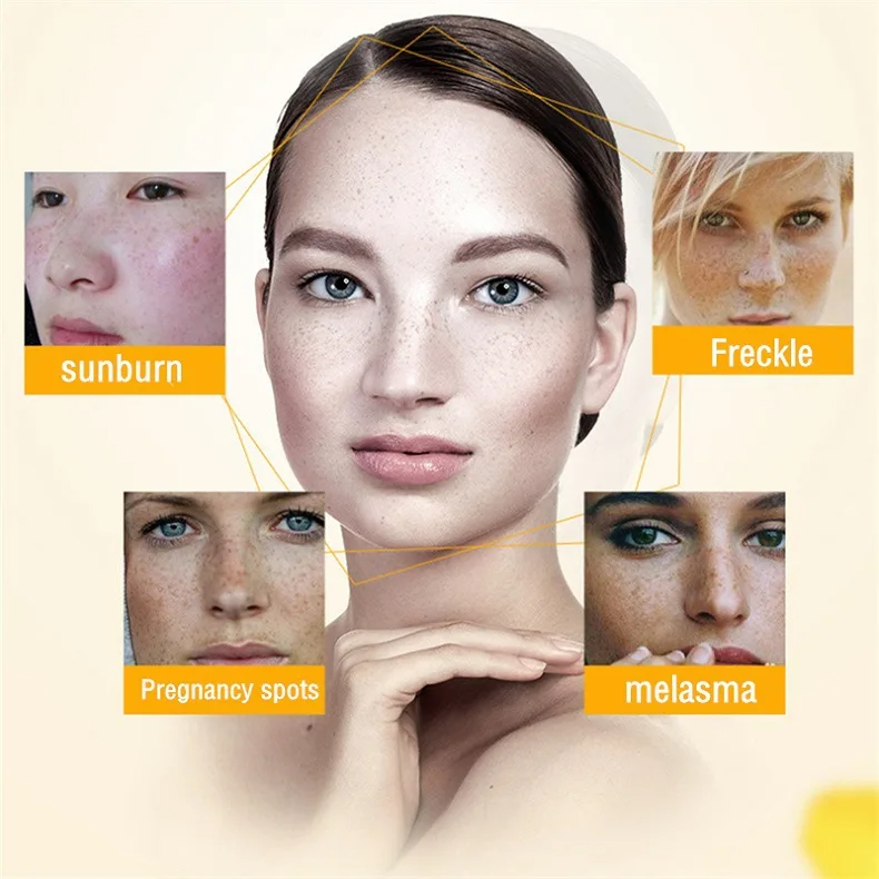 Clareamento creme de sardas re - Charcoal Whitening Paste avaliação e preço