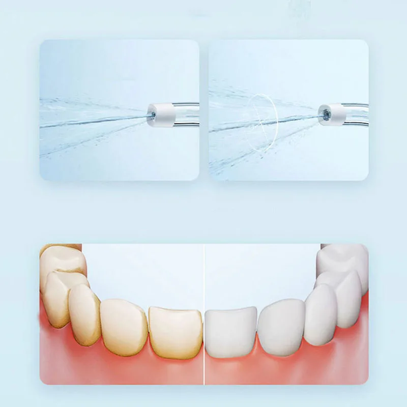 Irrigador Oral Portátil Xiaomi - Teeth Whitening Quick avaliação e preço