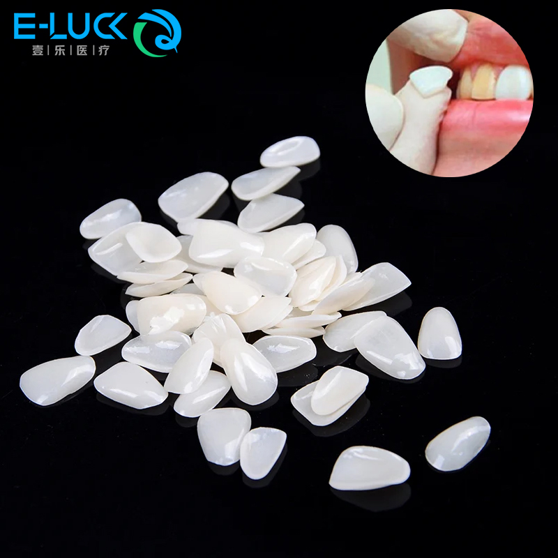 50 pçs folheados de dentes den - Teeth Whitening Veneers avaliação e preço