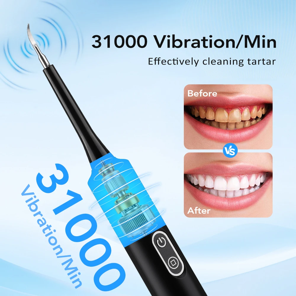 Escova de Dentes Elétrica com  - Teeth Whitening And Stain Removal avaliação e preço